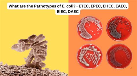 Bacteriology Microbiology Note