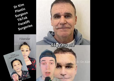 Who Is Dr Kim Plastic Surgeon Tiktok Alleged Scary Facelift Surgeries