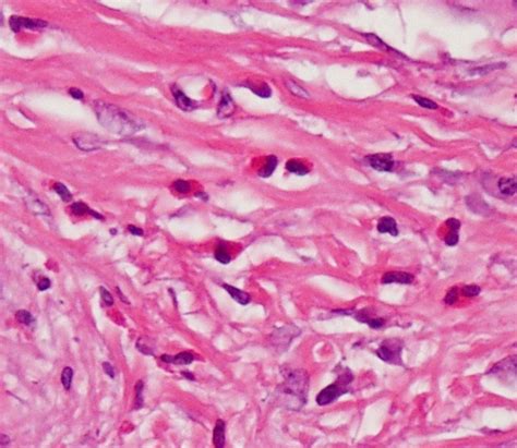 Moran Core Cellular Histopathology