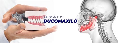 O Que É Bucomaxilo - Bucomaxilo - Hospital 22 de Outubro