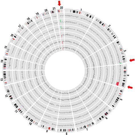 Circos Plot Of The Detected Copy Number Aberrations Across The Genome