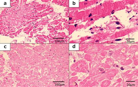 Pathological Examination Using Hematoxylineosin H E Staining Photo