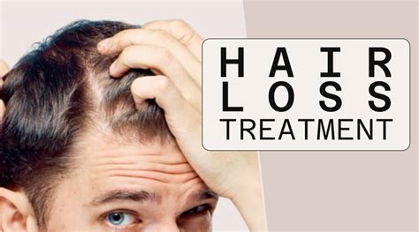 What’s the Best Hair Loss Treatment for Men? - MINOXIDIL