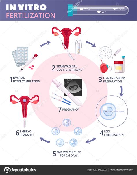 Como Funciona A Fertilização In Vitro - Diagrama De Fertilizacao In Vitro Clínica Fertilizar