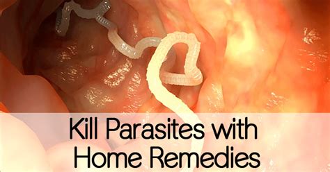 Kill Parasites with Home Remedies