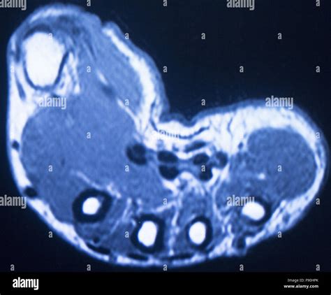 MRT Magnet Resonanz Tomographie Medizinische Scan Testergebnisse Von