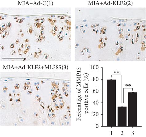 Klf Protects Against Mia Induced Osteoarthritis In Vivo A Schematic