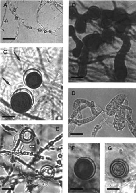 Ac Pythium Catenulatum A Chains Of Hyphal Swellings B Inflated