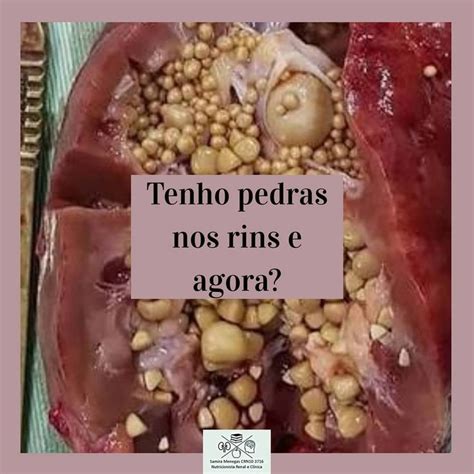 Pin em Nutrição e Nefrologia