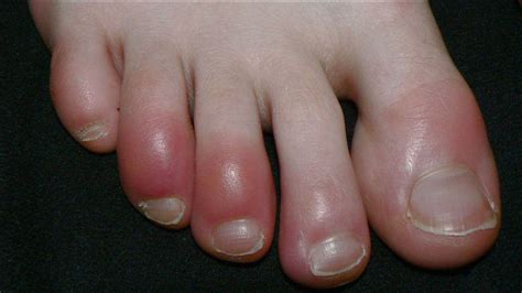 Helpful Foot Tips June Ses Podiatry