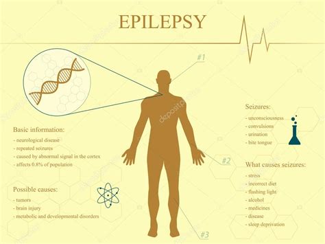 Infografía De La Enfermedad De La Epilepsia Con Silueta Del Hombre 2023