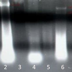 Agarose Gel Electrophoresis Stained With Ethidium Bromide Demonstrating