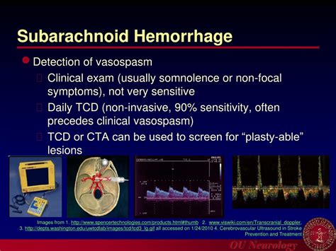 Ppt Introduction To Carotid Ultrasound And Transcranial Doppler