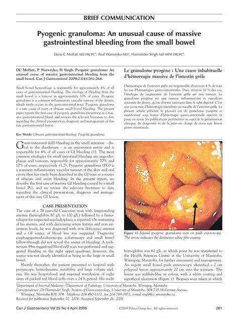 PDF Pyogenic Granuloma An Unusual Cause Of Massive Gastrointestinal