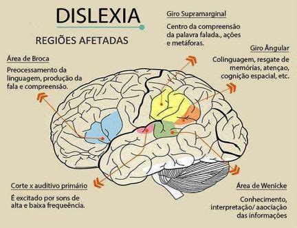 Dislexia Artofit