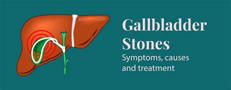 Gallbladder Stones: Symptoms, Causes and Treatment