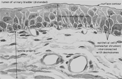 Hls Urinary System Urinary Bladder Transitional Epithelium High