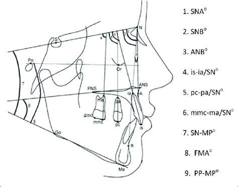 Skeletal And Dental Angular Measurements Skeletal Sagittal Download Scientific Diagram