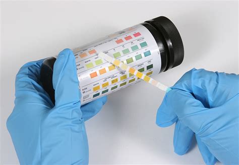 Urinalysis Healthcommunities Provider Services