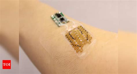 Novel Smart Bandages Can Monitor Treat Chronic Wounds Times Of India