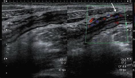 Ultrasound | Abdominal Key