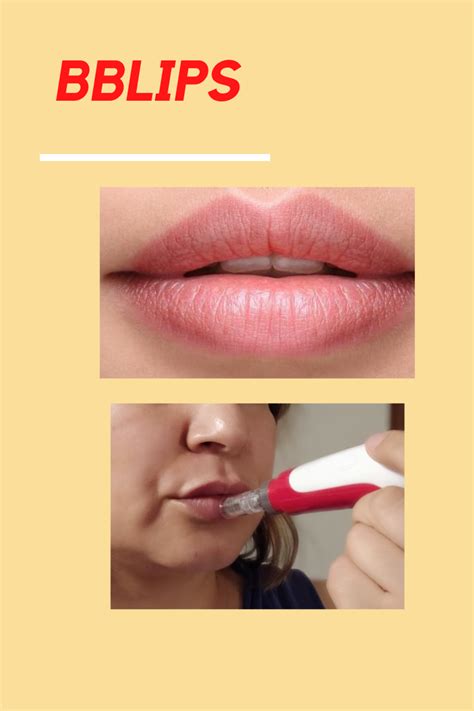 Tita Eve Bb Lips Labios Mas Jugosos Hidratados Y Con Color Con Dermapen