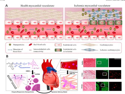 Figure 2 From Reactive Oxygen Species Based Nanomaterials For The Treatment Of Myocardial