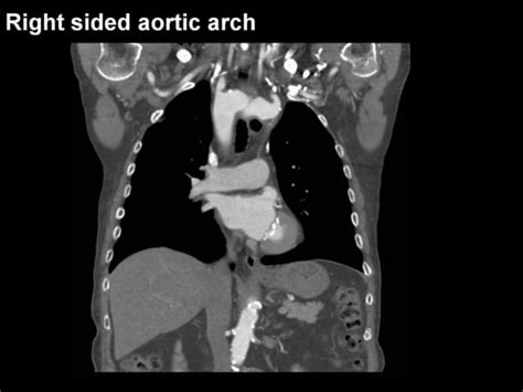 28 Dr Ahmed Esawy Imaging Oral Board Of Chest Imaging Variety Part