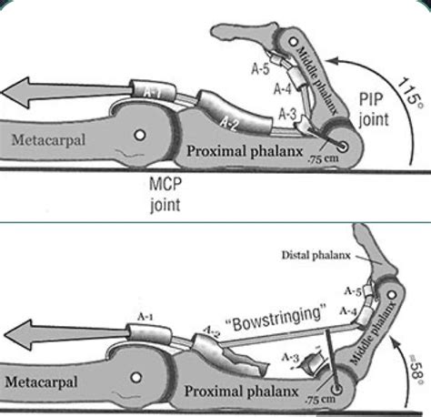 Flexor Pulley System of the Fingers