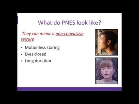 An Overview of Psychogenic Non Epileptic Seizures (PNES) - YouTube