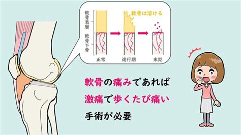 『ひざのねじれをとれば、ひざ痛は治る』著者の解説映像を無料で差し上げます！｜土屋元明姿勢と歩きの専門家）