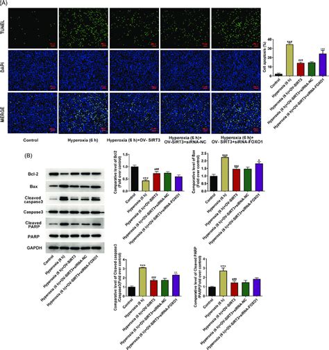 Foxo Knockdown Reverses The Suppressive Role Of Sirt Overexpression