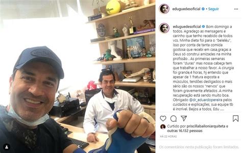 Edu Guedes comenta recuperação após cirurgia delicada no braço