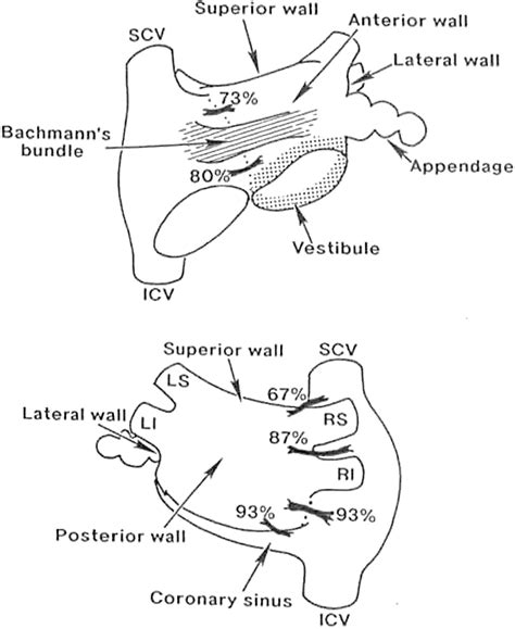 Reply Epicardial Connection A Major Pitfall To Find Gaps After Wide