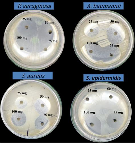 Image Of Agar Diffusion Assay Of Different Concentrations Of Zno Nps 3