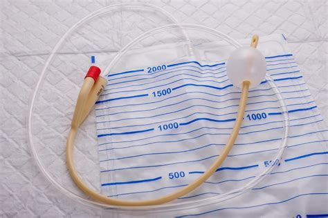 Indwelling Catheter