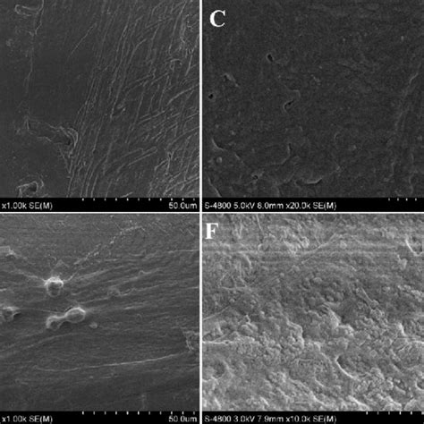 Sem Captures Of Ucmsc Adherence On Surface Of Pcl Scaffolds The