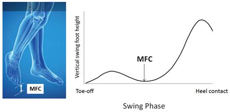 Sensors Free Full Text Shoe Insole Technology For Injury Prevention