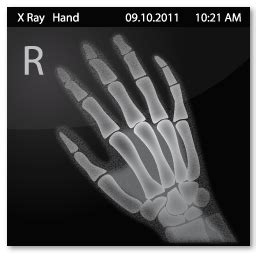 X Ray Hand Icon | Download Vista Medical icons | IconsPedia