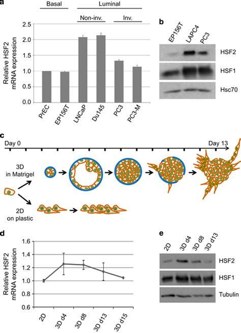 Expression Patterns Of HSF2 In PrCa Cell Lines And During Organotypic