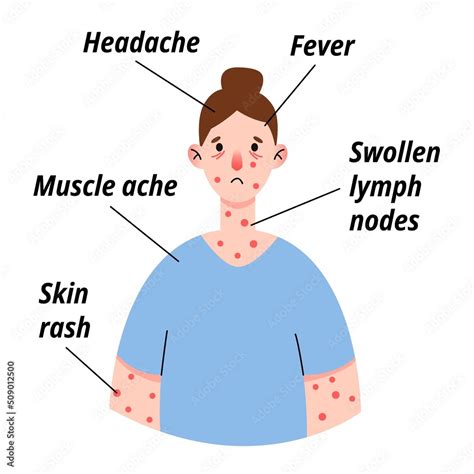 Monkeypox Virus Symptom Infographic On Woman Patient With Fever