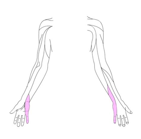 ue dermatome map unit  flashcards quizlet