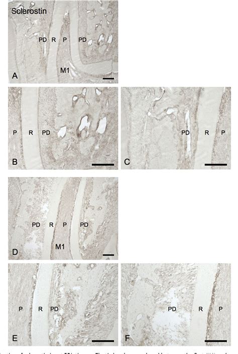 Figure From Expression Of Sost Sclerostin In Compressed Periodontal