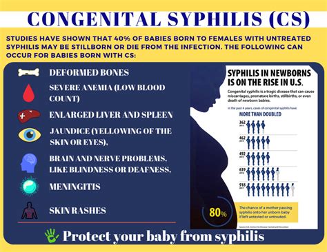 Congenital Syphilis Georgia Department Of Public Health