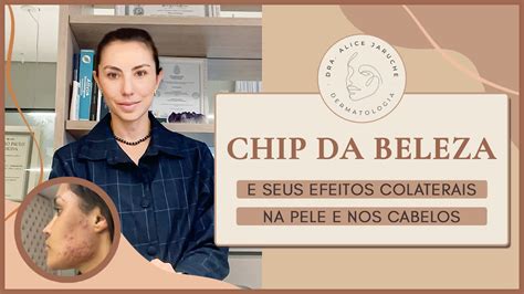 Chip Da Beleza E Seus Efeitos Colaterais Na Pele E Nos Cabelos Dra