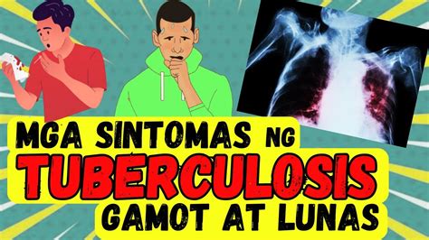 Mga SINTOMAS Ng TUBERCULOSIS O TB Gamot At Lunas Para Gumaling Ang