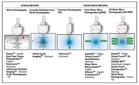 Biomedinformatics Free Full Text Ultrasound Elastography Basic