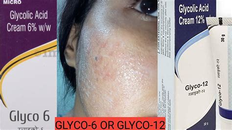 Glycolic Acid Cream Vs Glycolic Acid How To Use Glycolic Acid