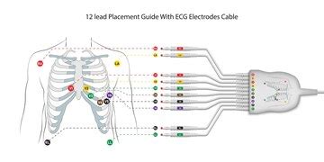 Premium Vector | 12 leads electrocardiograph placement guide with cable ...