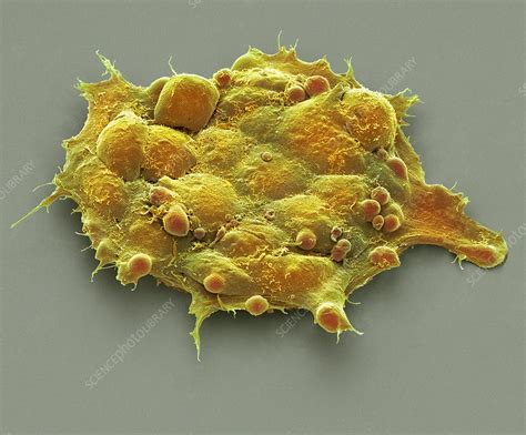 Pluripotent Stem Cells SEM Stock Image C023 0269 Science Photo